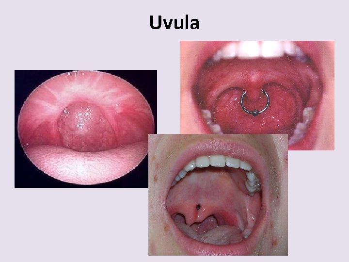 Uvula 