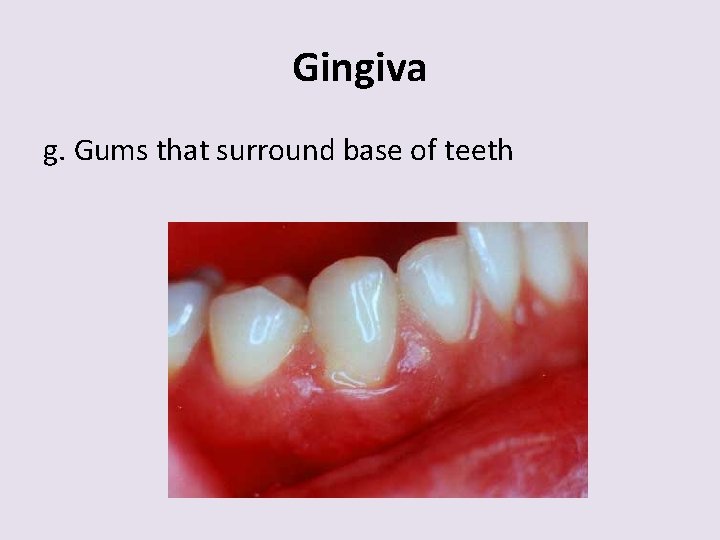 Gingiva g. Gums that surround base of teeth 