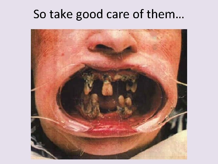 So take good care of them… 