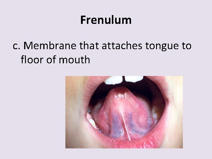 Frenulum c. Membrane that attaches tongue to floor of mouth 