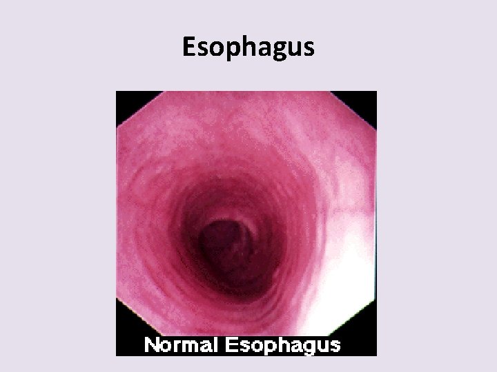 Esophagus 