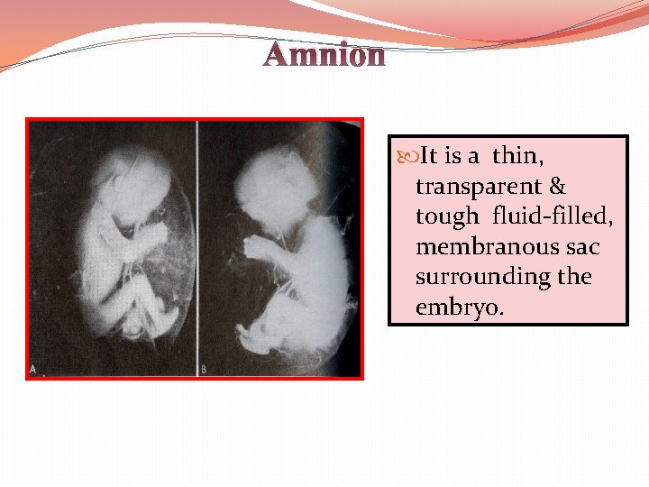 Amnion It is a thin, transparent & tough fluid-filled, membranous sac surrounding the embryo.
