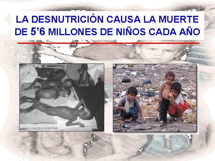 LA DESNUTRICIÓN CAUSA LA MUERTE DE 5’ 6 MILLONES DE NIÑOS CADA AÑO 