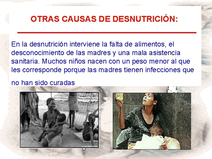 OTRAS CAUSAS DE DESNUTRICIÓN: En la desnutrición interviene la falta de alimentos, el desconocimiento