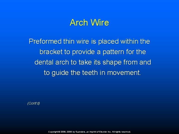 Arch Wire Preformed thin wire is placed within the bracket to provide a pattern