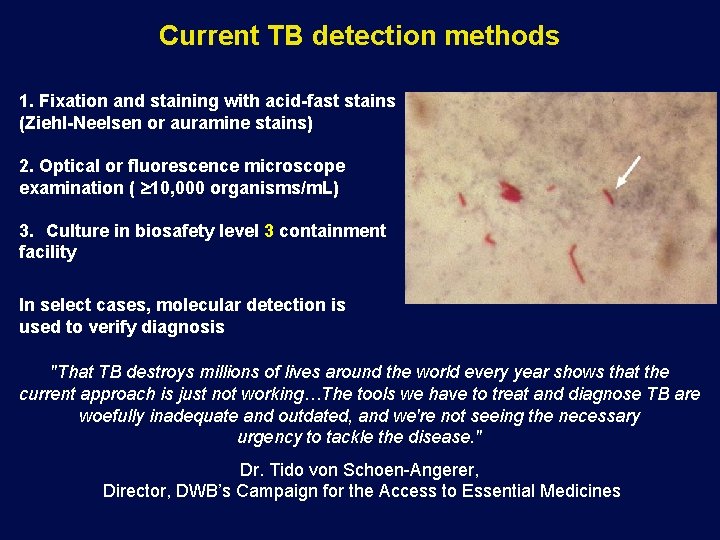 Current TB detection methods 1. Fixation and staining with acid-fast stains (Ziehl-Neelsen or auramine