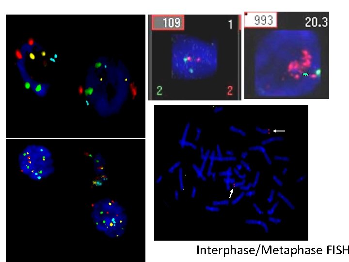 Interphase/Metaphase FISH 