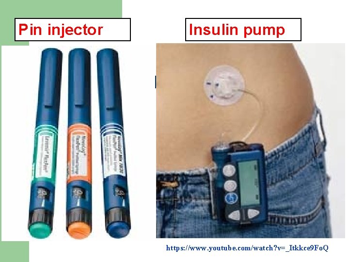 Pin injector Insulin pump https: //www. youtube. com/watch? v=_Itkkce 9 Fo. Q 