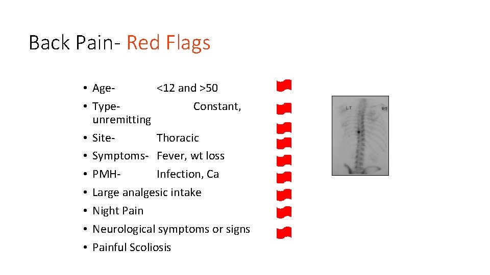 Back Pain- Red Flags • Age<12 and >50 • Type. Constant, unremitting • Site.