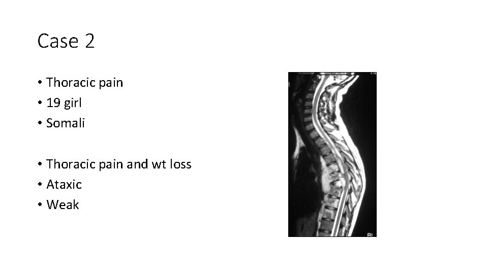 Case 2 • Thoracic pain • 19 girl • Somali • Thoracic pain and