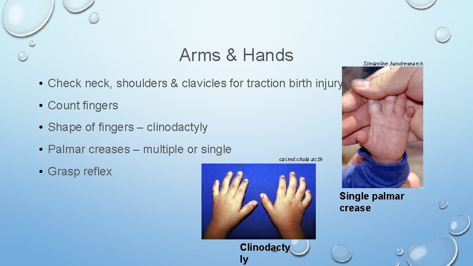 Arms & Hands Simianline. handresearch. com • Check neck, shoulders & clavicles for traction