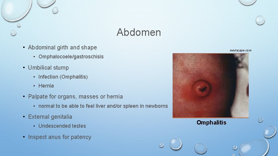 Abdomen • Abdominal girth and shape medscape. com • Omphalocoele/gastroschisis • Umbilical stump •