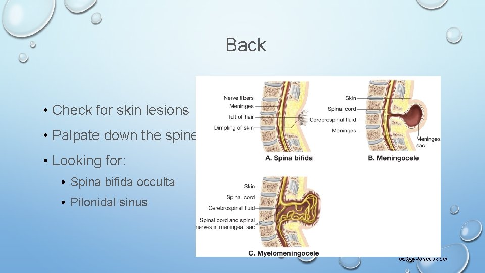 Back • Check for skin lesions • Palpate down the spine • Looking for: