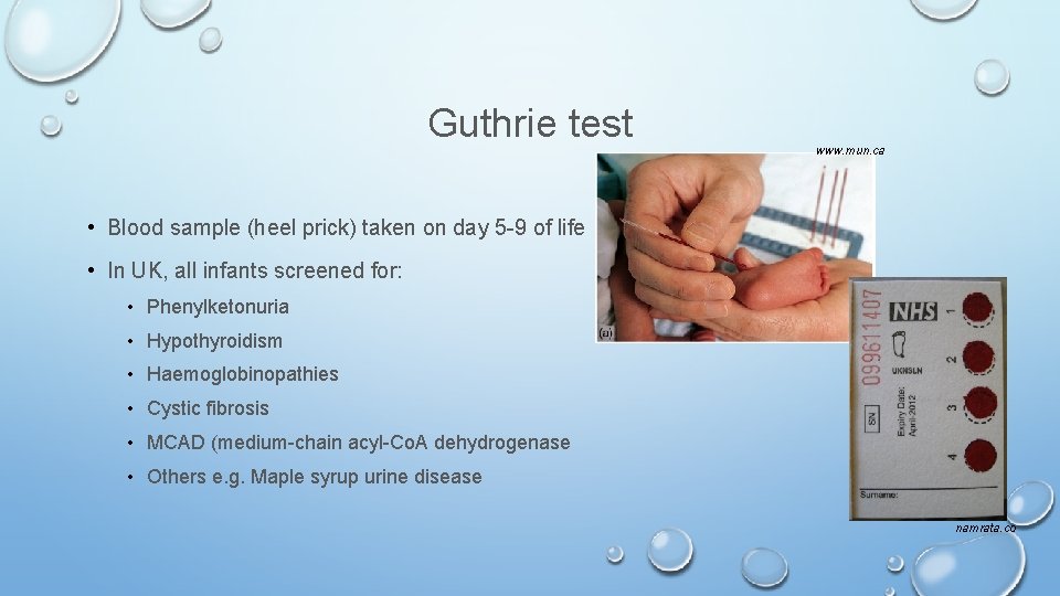 Guthrie test www. mun. ca • Blood sample (heel prick) taken on day 5