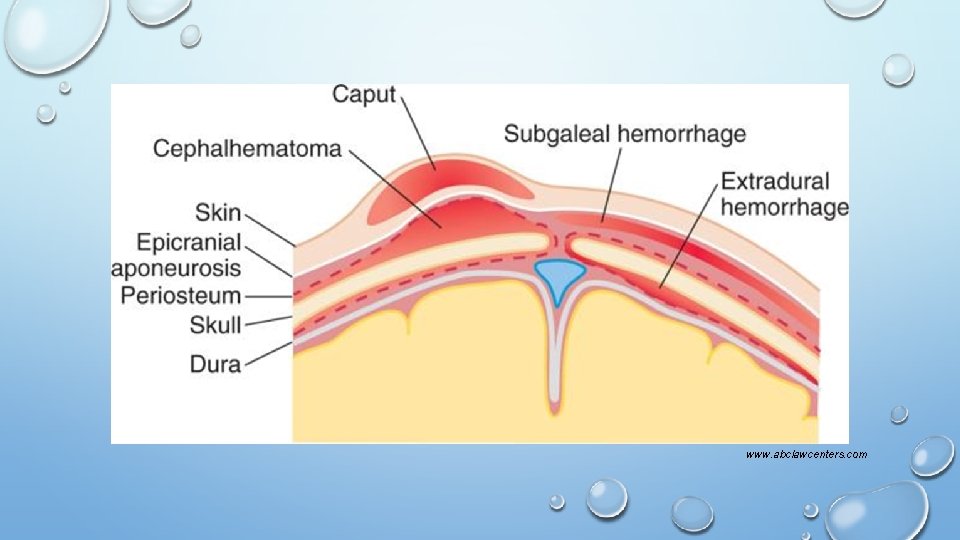 www. abclawcenters. com 