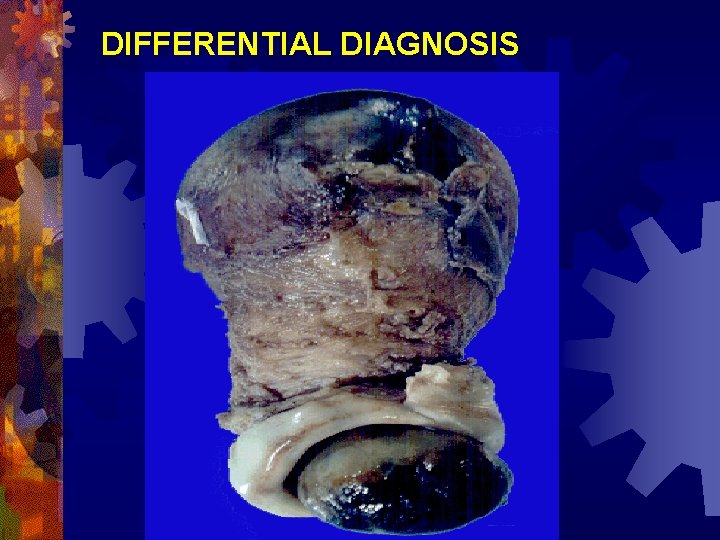 DIFFERENTIAL DIAGNOSIS 