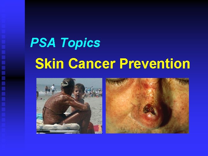 PSA Topics Skin Cancer Prevention 