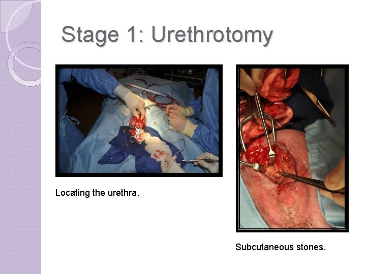 Stage 1: Urethrotomy Locating the urethra. Subcutaneous stones. 