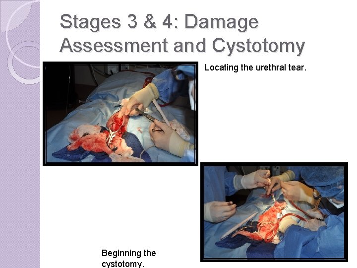 Stages 3 & 4: Damage Assessment and Cystotomy Locating the urethral tear. Beginning the
