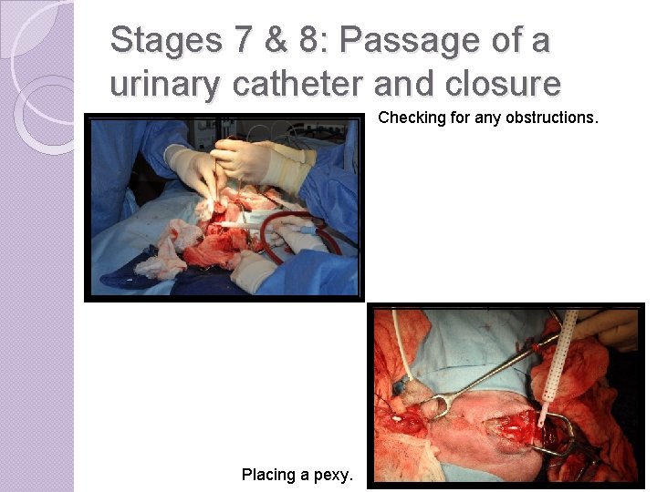 Stages 7 & 8: Passage of a urinary catheter and closure Checking for any