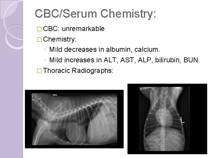 CBC/Serum Chemistry: � CBC: unremarkable � Chemistry: ◦ Mild decreases in albumin, calcium. ◦