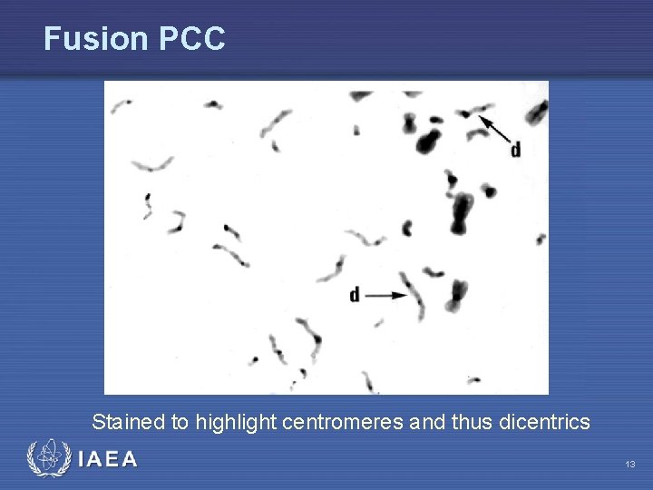 Fusion PCC Stained to highlight centromeres and thus dicentrics IAEA 13 