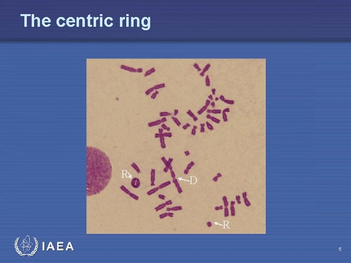 The centric ring R D R IAEA 5 