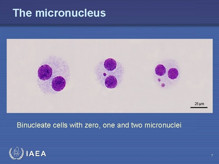 The micronucleus Binucleate cells with zero, one and two micronuclei IAEA 7 