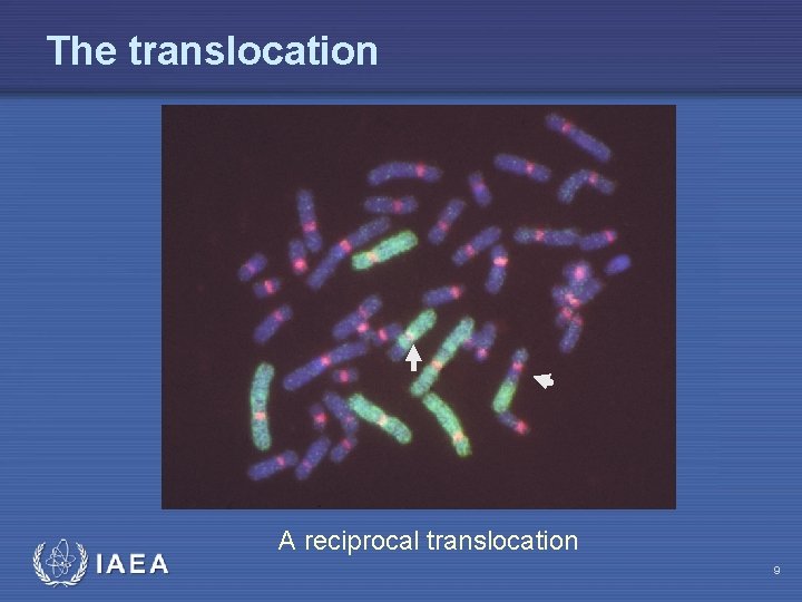 The translocation IAEA A reciprocal translocation 9 