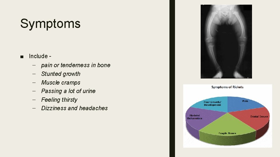 Symptoms ■ Include – – – – pain or tenderness in bone Stunted growth
