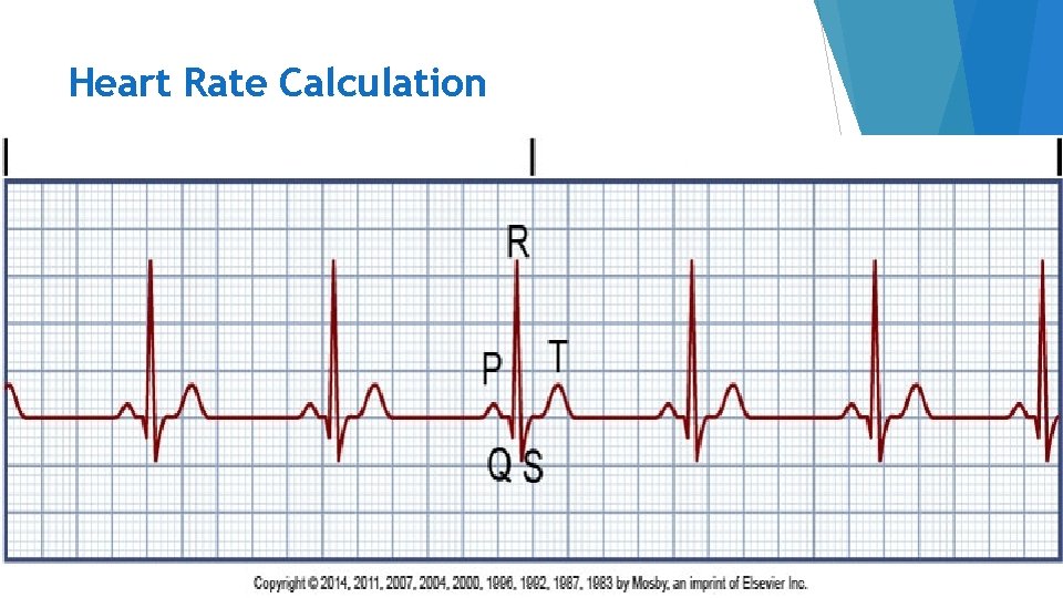 Heart Rate Calculation 45 