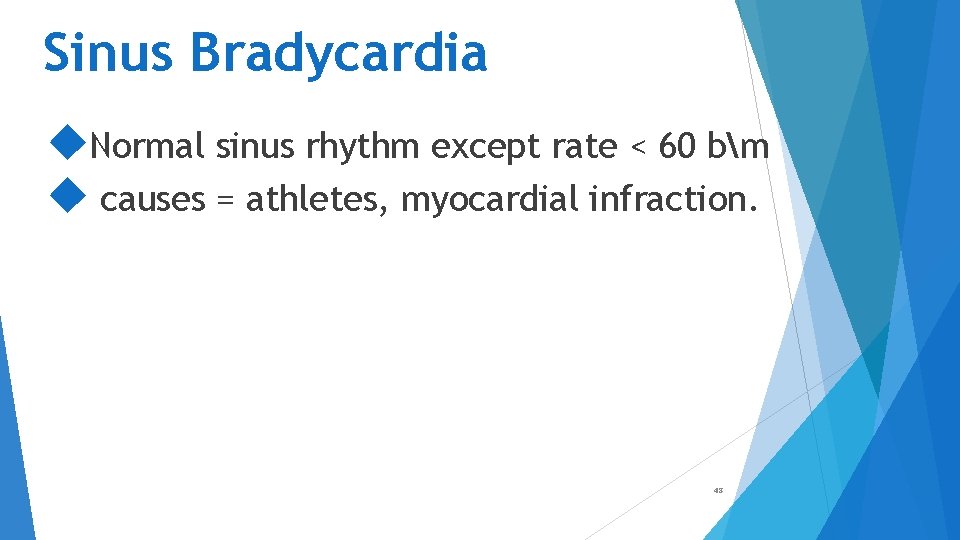 Sinus Bradycardia Normal sinus rhythm except rate < 60 bm causes = athletes, myocardial