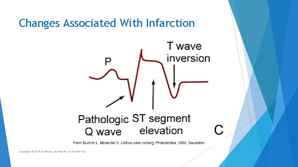 Changes Associated With Infarction Copyright © 2014 by Mosby, an imprint of Elsevier Inc.