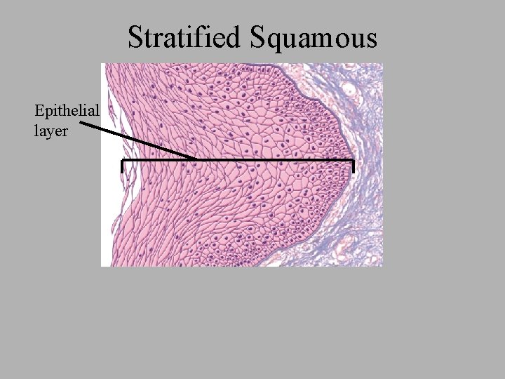 Stratified Squamous Epithelial layer 