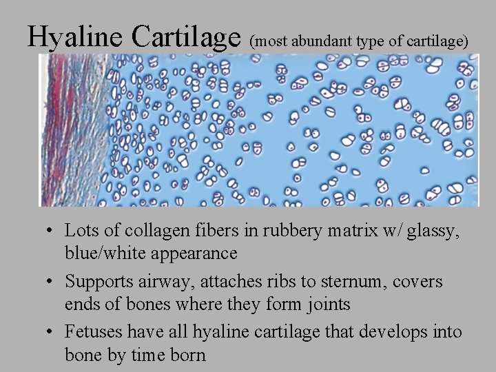 Hyaline Cartilage (most abundant type of cartilage) • Lots of collagen fibers in rubbery