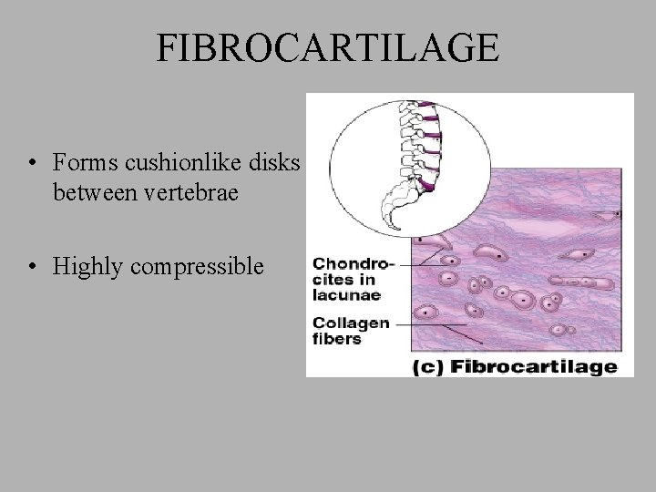 FIBROCARTILAGE • Forms cushionlike disks between vertebrae • Highly compressible 