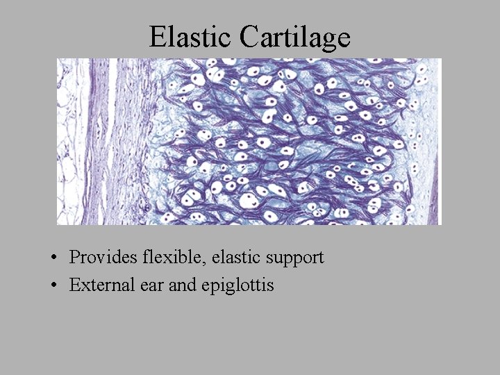 Elastic Cartilage • Provides flexible, elastic support • External ear and epiglottis 