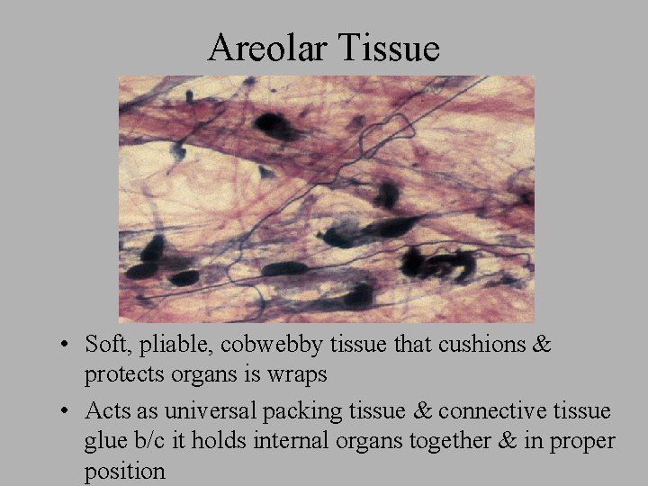 Areolar Tissue • Soft, pliable, cobwebby tissue that cushions & protects organs is wraps