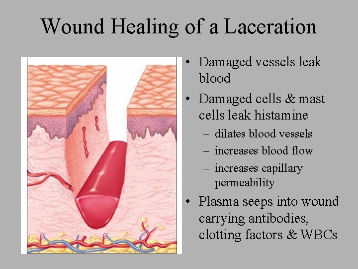 Wound Healing of a Laceration • Damaged vessels leak blood • Damaged cells &