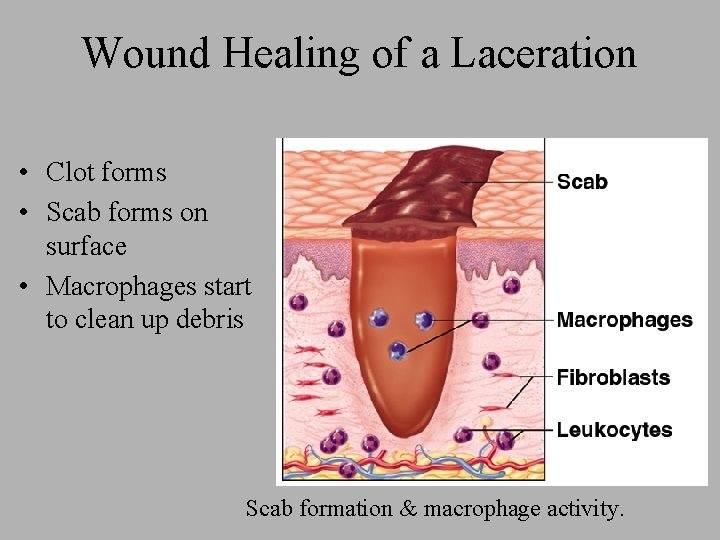 Wound Healing of a Laceration • Clot forms • Scab forms on surface •