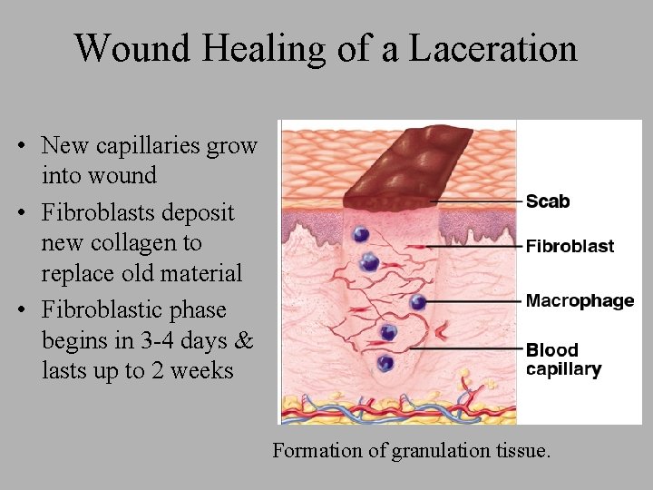 Wound Healing of a Laceration • New capillaries grow into wound • Fibroblasts deposit