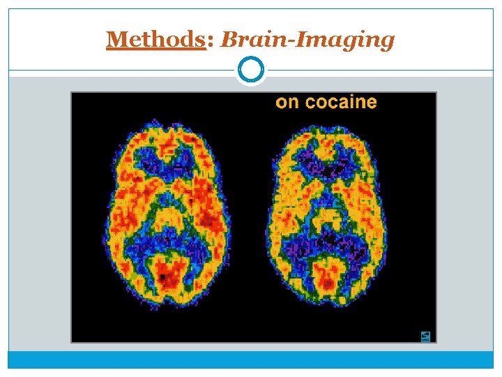 Methods: Brain-Imaging 