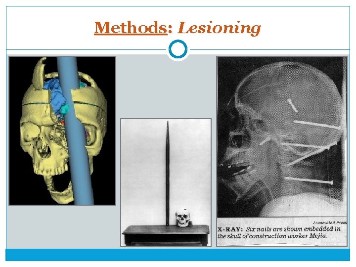 Methods: Lesioning 