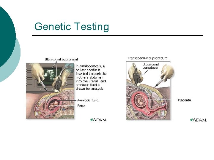 Genetic Testing 