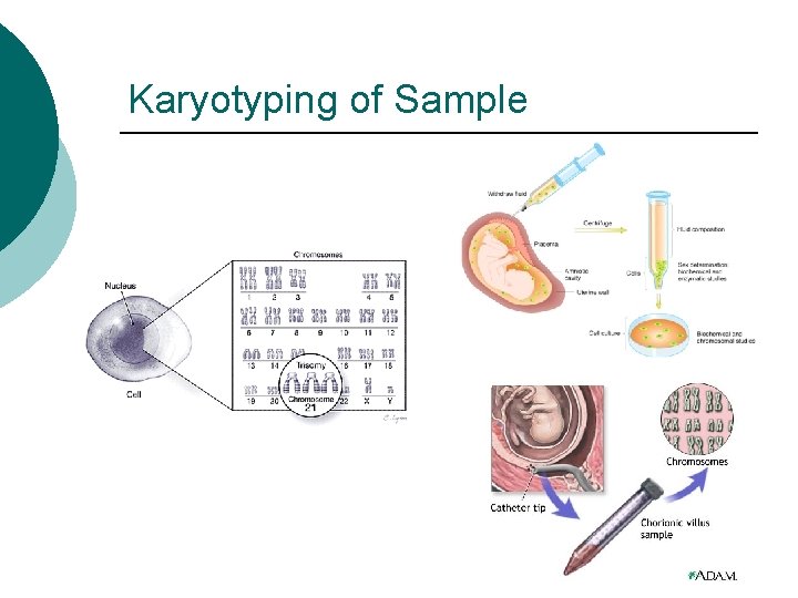 Karyotyping of Sample 
