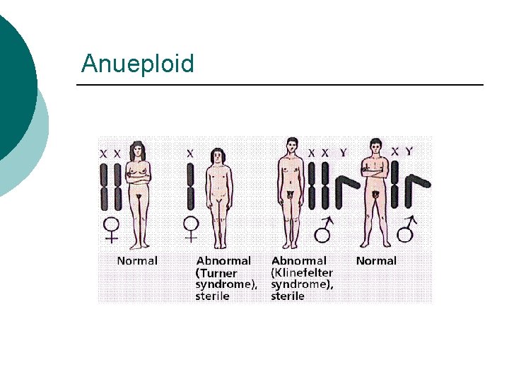 Anueploid 