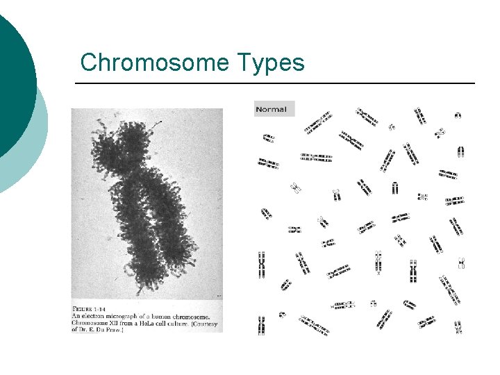 Chromosome Types 
