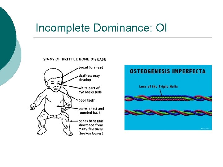 Incomplete Dominance: OI 