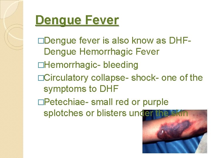 Dengue Fever �Dengue fever is also know as DHFDengue Hemorrhagic Fever �Hemorrhagic- bleeding �Circulatory
