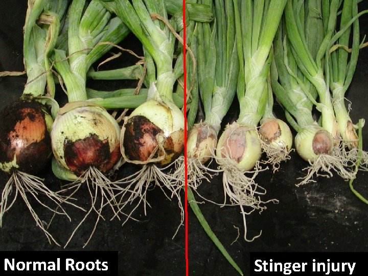 Normal Roots Stinger injury 